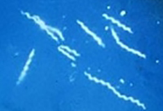 Spirochetes burrow into tissue to infect it. (B. burgdorferi, CDC image)